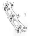 Fig. 02 - Anterior cervical plate