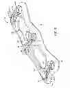 Fig. 06 - Anterior cervical plate