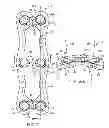 Fig. 07 - Anterior cervical plate