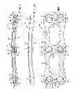 Fig. 08 - Anterior cervical plate