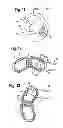 Fig. 06 - Intervertebral implant