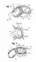 Fig. 07 - Intervertebral implant