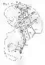 Fig. 02 - BONE FIXATION WITH OVERLAPPING BONE PLATES