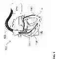 Fig. 02 - Implantable defibrillation arrangement and electrode lead