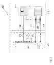 Fig. 04 - Implantable defibrillation arrangement and electrode lead