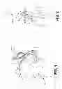 Fig. 02 - Laparoscopic implantation of neurostimulators