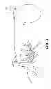 Fig. 03 - Laparoscopic implantation of neurostimulators
