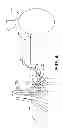 Fig. 04 - Laparoscopic implantation of neurostimulators