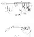 Fig. 07 - Remote pace detection in an implantable medical device