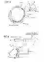 Fig. 04 - Method and apparatus for treating ischemic diseases