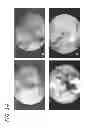 Fig. 09 - Method and apparatus for treating ischemic diseases