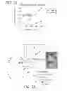 Fig. 13 - Method and apparatus for treating ischemic diseases