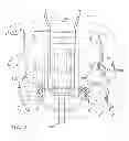 Fig. 06 - Implantable lead with tethers