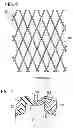 Fig. 07 - Stent delivery system and manufacturing method for the same