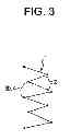Fig. 04 - STENT GRAFT DEVICE