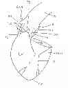 Fig. 01 - Oval Aortic Valve