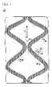 Fig. 06 - STENT