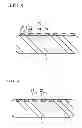 Fig. 07 - STENT