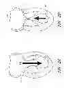 Fig. 06 - Device, system, and method for transcatheter treatment of valve regurgitation