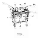 Fig. 09 - Bi-directional fixating/locking transvertebral body screw/intervertebral cage stand-alone constructs