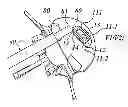 Fig. 01 - System for replacing an intervertebral disc
