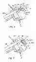Fig. 04 - System for replacing an intervertebral disc