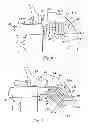 Fig. 05 - System for replacing an intervertebral disc