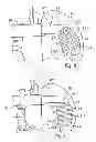 Fig. 06 - System for replacing an intervertebral disc