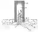 Fig. 01 - COMPOSITE IMPLANT