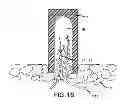 Fig. 08 - COMPOSITE IMPLANT