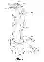 Fig. 02 - Cutting unit with guard teeth and hair-cutting device