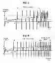 Fig. 07 - Power Tool