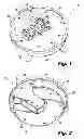 Fig. 02 - Knotless endostitch package