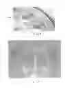 Fig. 08 - Light-directing apparatus with protected reflector-shield and lighting fixture utilizing same