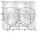Fig. 01 - Obstacle detection system with ultrasonic sensors located at either side of a bumper, having own beam axes at an angle deflected in a horizontal direction from a surface-normal direction of the bumper