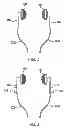 Fig. 03 - System and method for securing headphone transducers
