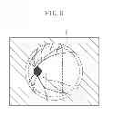 Fig. 07 - Image processing apparatus for fundus image, image processing method for fundus image, and program medium
