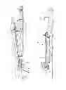Fig. 02 - Method and portable apparatus for forcing a pipeline into or out of a borehole
