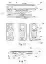 Fig. 07 - PERISTALTIC SYSTEM, FLUID DELIVERY DEVICE, PIPETTING DEVICE, SLEEVE AND METHOD FOR OPERATING THE PERISTALTIC SYSTEM