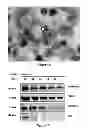 Fig. 02 - EXOSOME INHIBITING AGENTS AND USES THEREOF