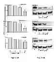 Fig. 11 - EXOSOME INHIBITING AGENTS AND USES THEREOF