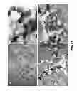 Fig. 15 - EXOSOME INHIBITING AGENTS AND USES THEREOF