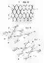 Fig. 05 - Method for shaping a material with a reticular structure, plant for performing same and reticular material resulting from the method