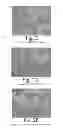 Fig. 03 - BIOLOGICAL FIXATIVE AND METHOD OF USING THE BIOLOGICAL FIXATIVE