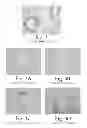 Fig. 04 - BIOLOGICAL FIXATIVE AND METHOD OF USING THE BIOLOGICAL FIXATIVE