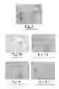Fig. 06 - BIOLOGICAL FIXATIVE AND METHOD OF USING THE BIOLOGICAL FIXATIVE