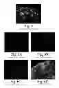 Fig. 07 - BIOLOGICAL FIXATIVE AND METHOD OF USING THE BIOLOGICAL FIXATIVE