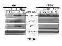 Fig. 13 - Process for the preparation of small molecule inhibitors of MDM2 and intermediates used therein
