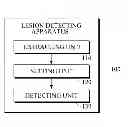 Fig. 01 - Apparatus and method for detecting lesion and lesion diagnosis apparatus