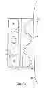 Fig. 11 - METHOD AND SYSTEM FOR APPLICATION OF THERMAL THERAPY RELATIVE TO THE TREATMENT OF DEEP-VEIN THROMBOSIS AND LYMPHEDEMA